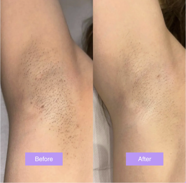 Cyperusglow™ – Cyperus Rotundus Skin Serum